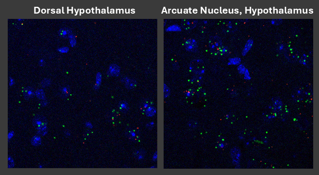 Visualizing intranuclear interactions of a neuronal DNA methyltransferase and a histone lysine methyltransferase in models of Huntington's disease.
