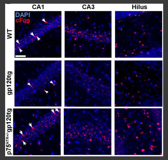 Visualizing intranuclear interactions of a neuronal DNA methyltransferase and a histone lysine methyltransferase in models of Huntington's disease.